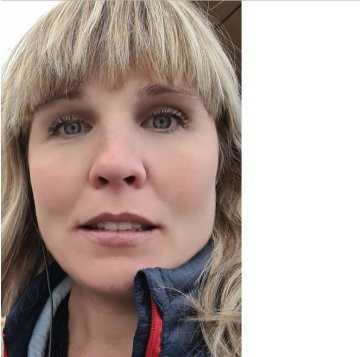 Långvarig hormonbehandling ökar risken för ljumskbråck