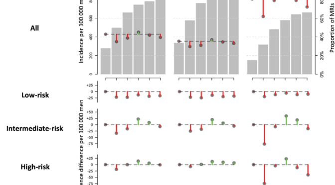 Prostatacancer i Sverige före, under och efter covid-19