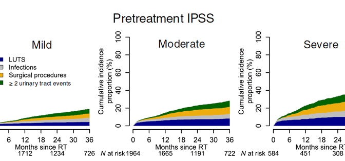 Förhöjd risk för urinvägshändelser efter strålbehandling vid prostatacancer hos män med högt IPSS